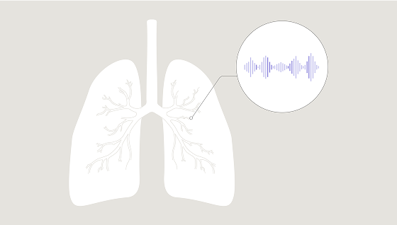Велкро крепитации