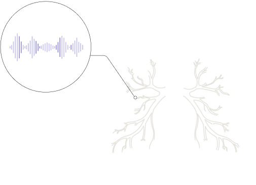 Lung image